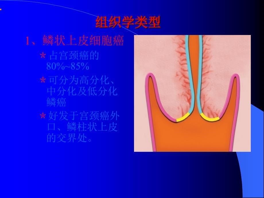 子宫颈癌ppt课件_第5页