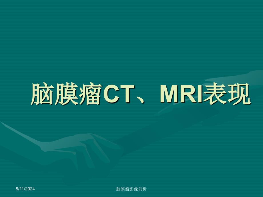 脑膜瘤CT、MRI表现_第1页