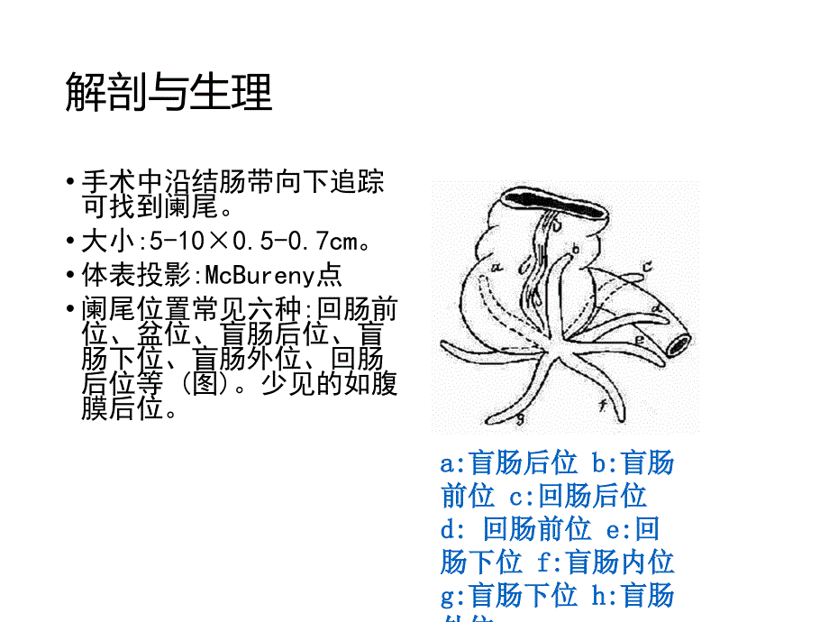 急性阑尾炎PPT_第4页