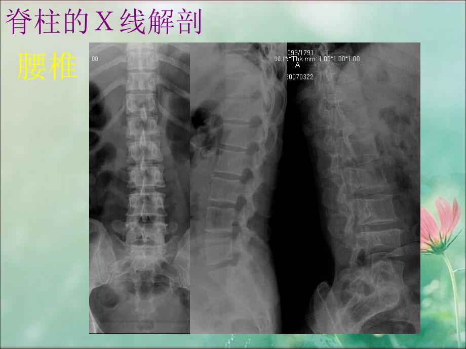 腰椎影像解剖学_第1页