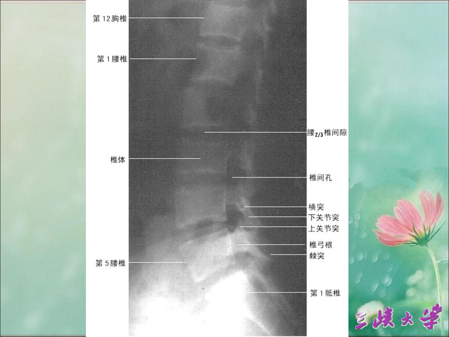 腰椎影像解剖学_第2页