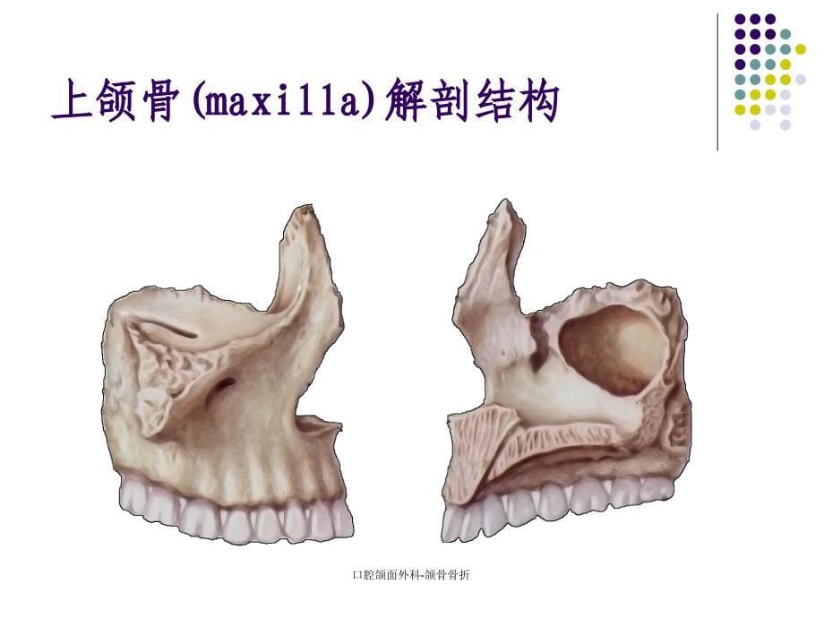 口腔颌面外科颌骨骨折_第5页