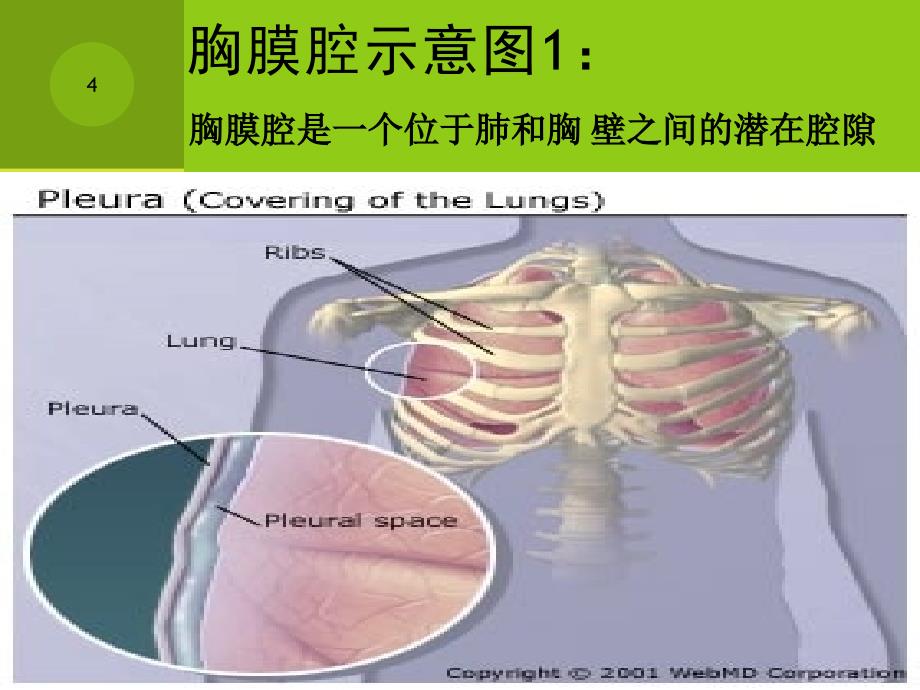 胸腔闭式引流术PPT课件同名33_第4页