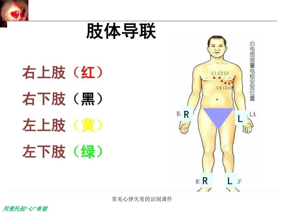 常见心律失常的识别课件_第4页