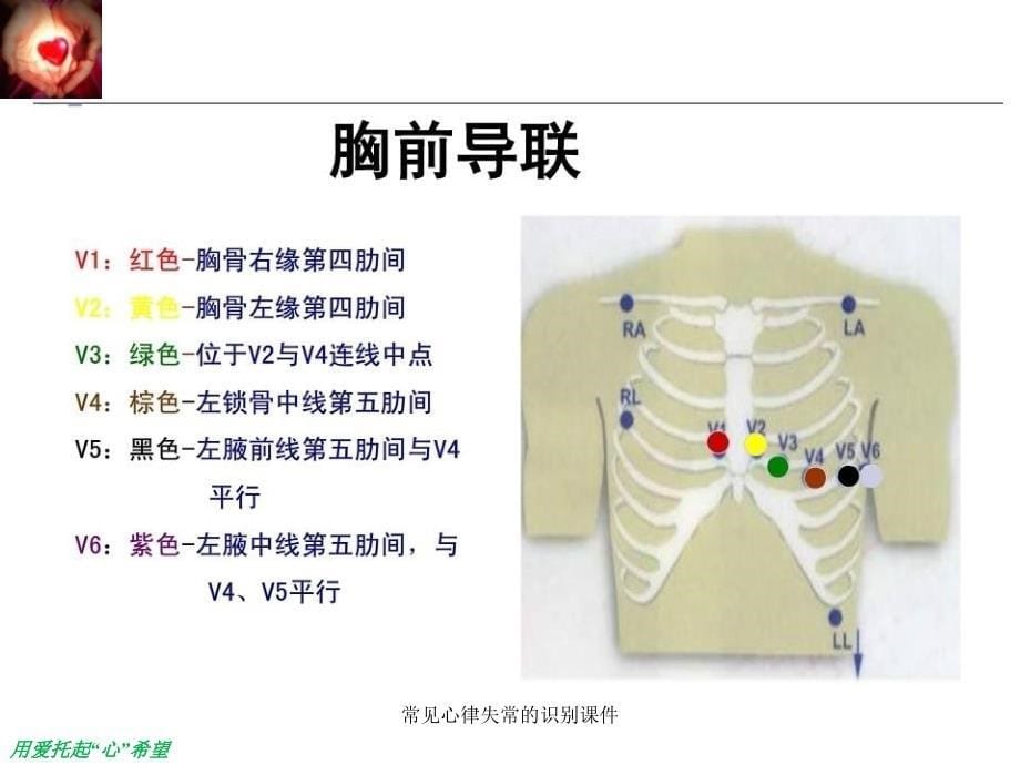 常见心律失常的识别课件_第5页