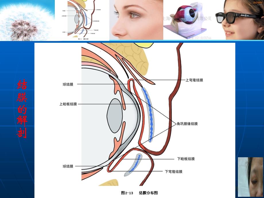 结膜炎眼科.ppt_第3页