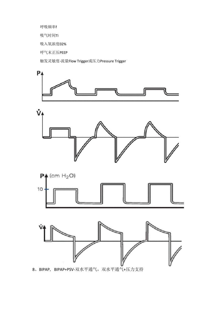呼吸机的通气模式介绍_第5页