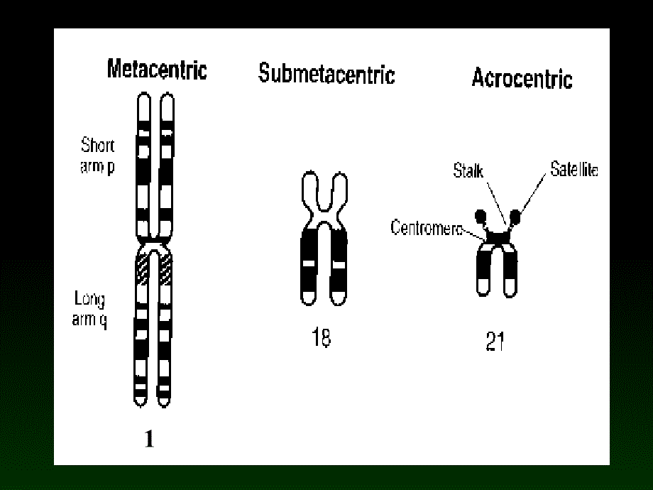 人类正常染色体与染色体畸变_第4页