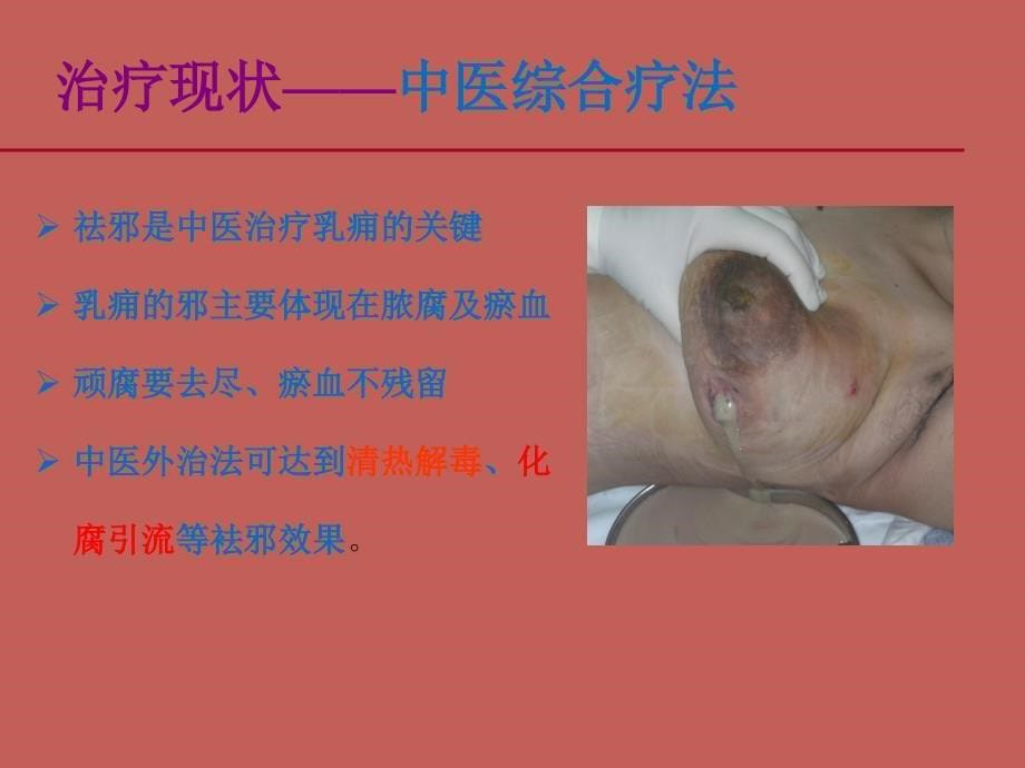 肉芽肿性乳腺炎中医药治疗难点与对策_第5页