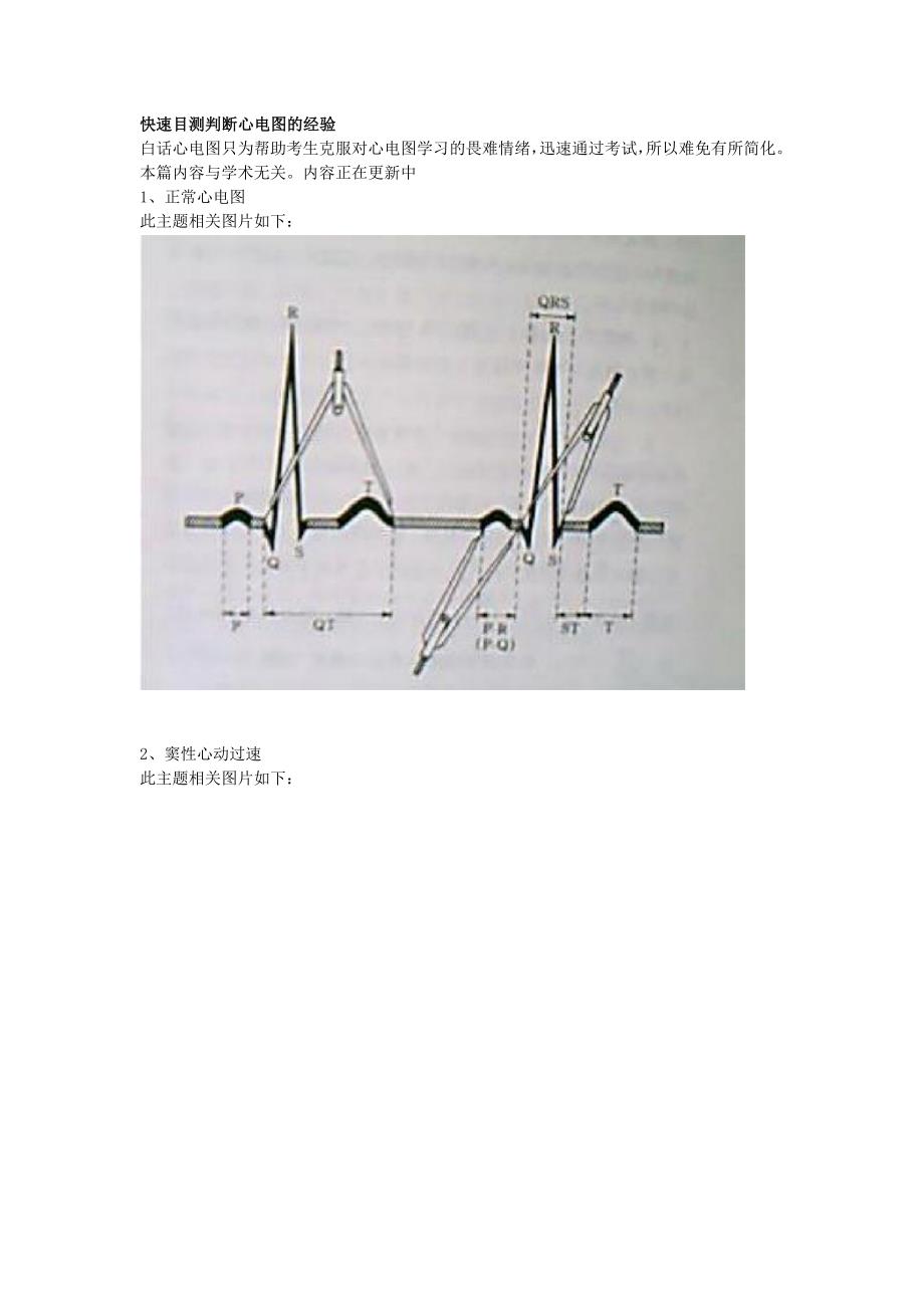 巧记心电图 2012.doc_第2页