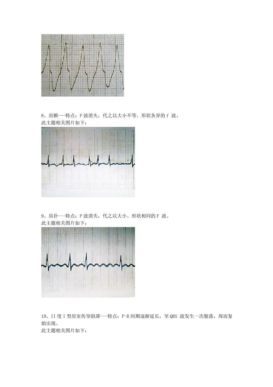 巧记心电图 2012.doc_第5页