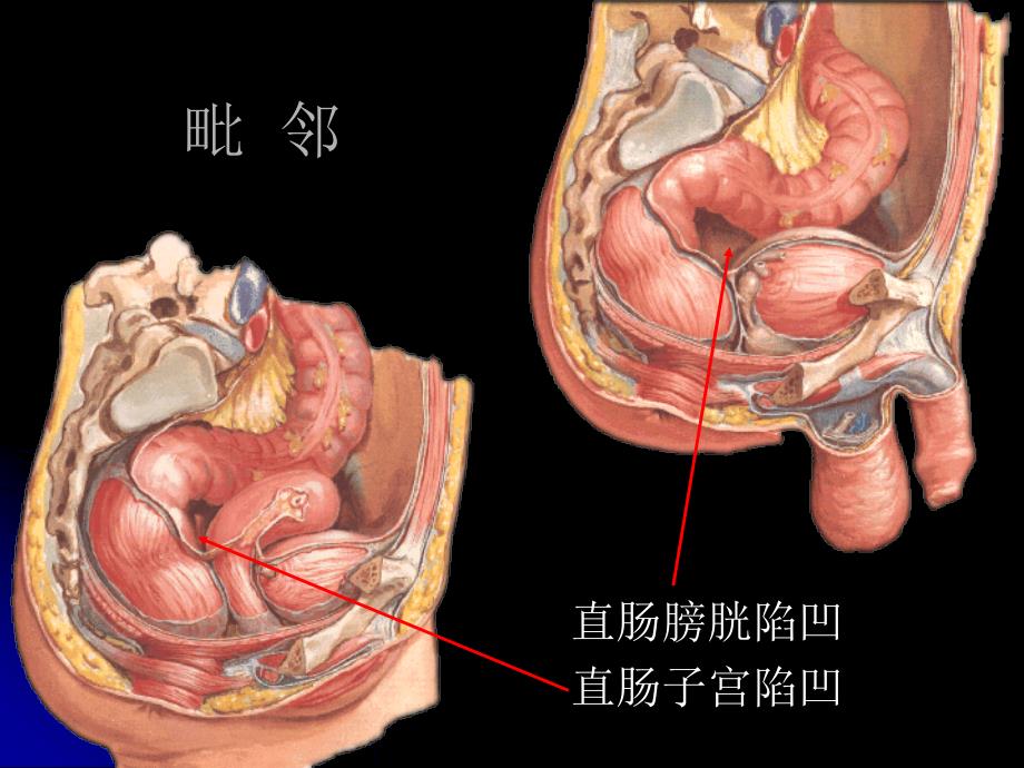 直肠肛管解剖PPT课件_第4页