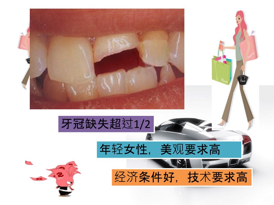 口腔修复病例_第1页