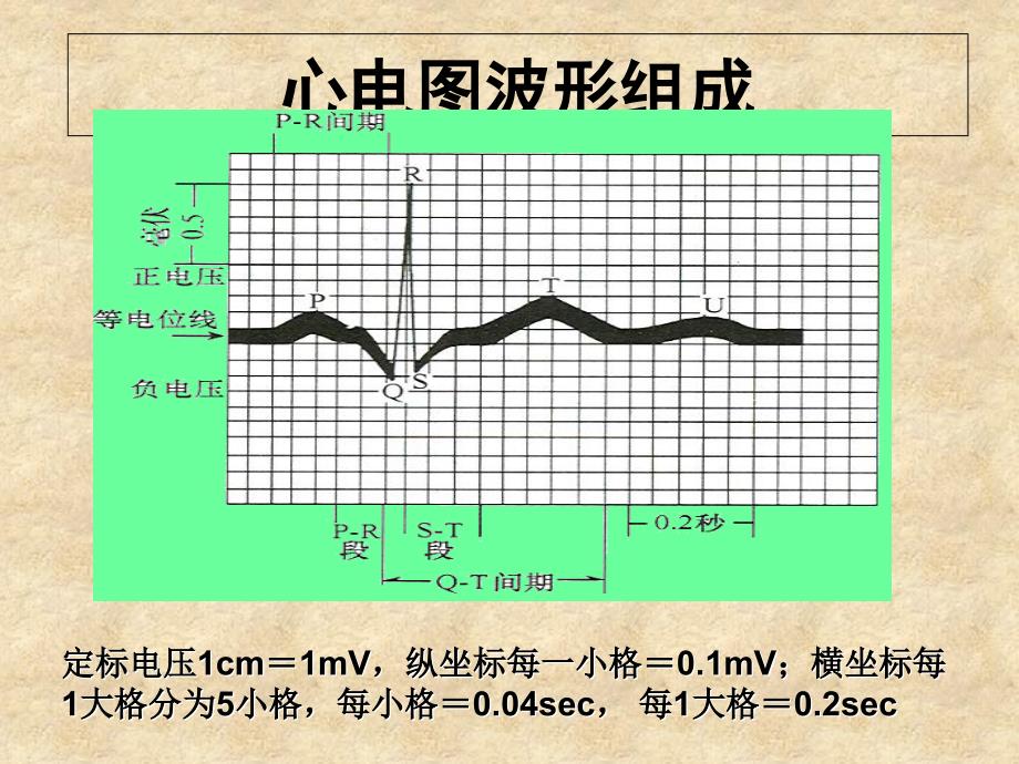 常见心律失常的心电图识别_第2页