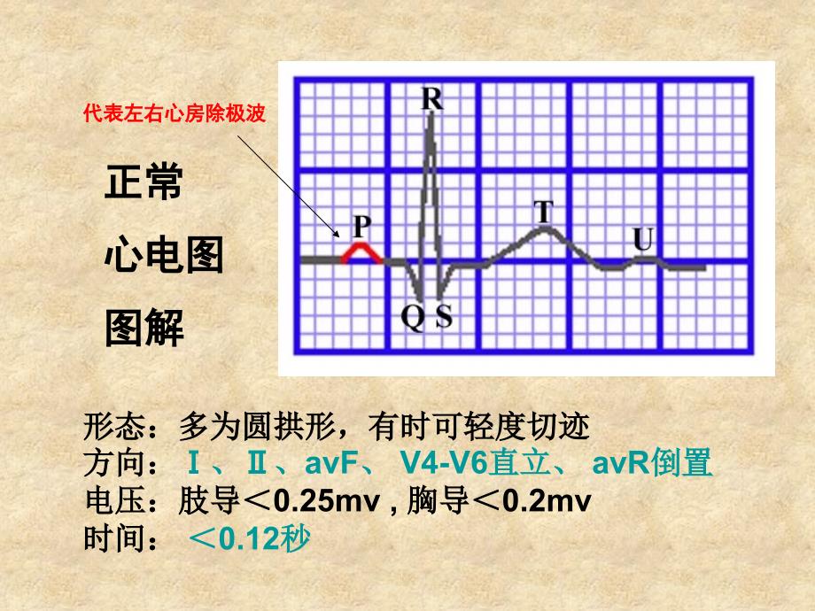 常见心律失常的心电图识别_第3页