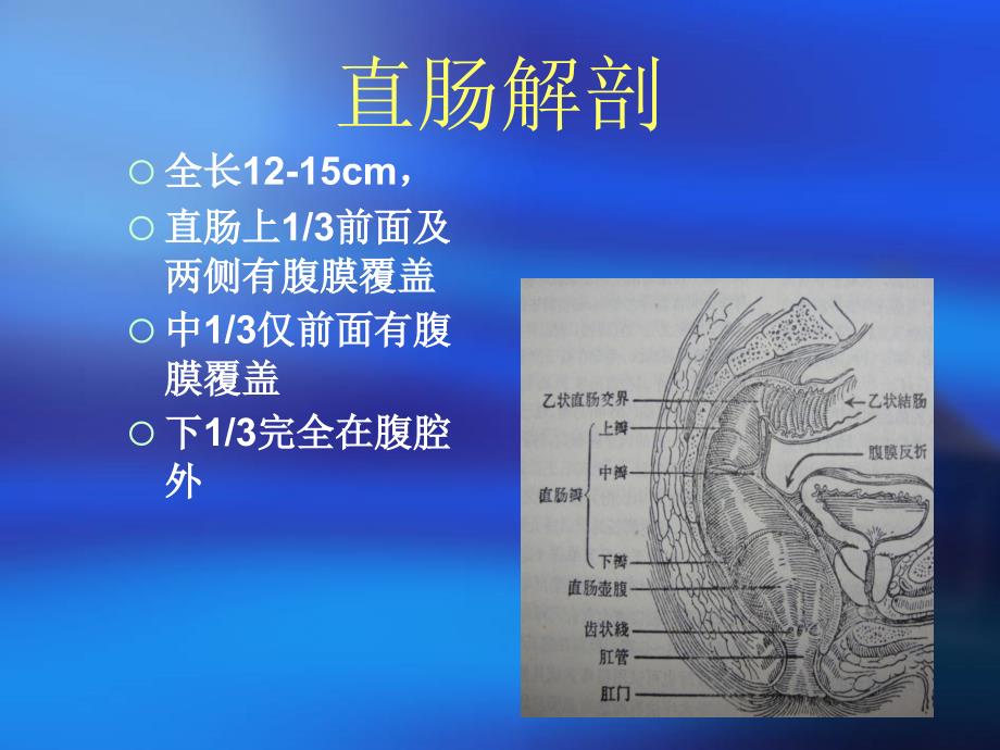 直肠癌手术配合讲义课件_第2页