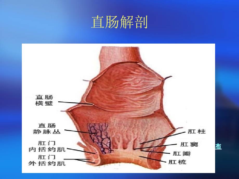 直肠癌手术配合讲义课件_第4页