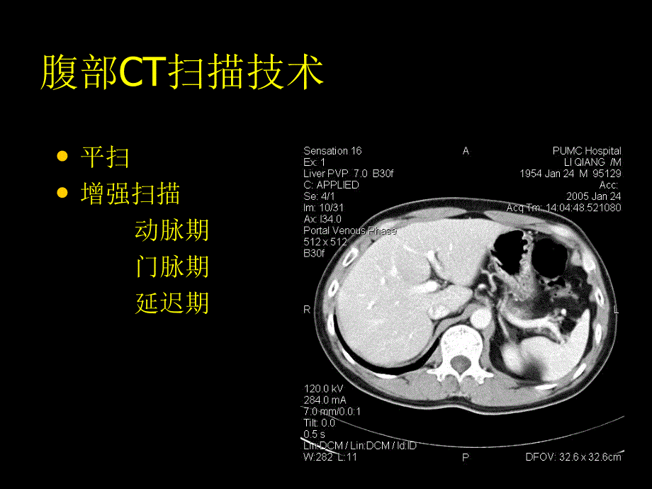 腹部CT正常解剖PPT课件_第3页