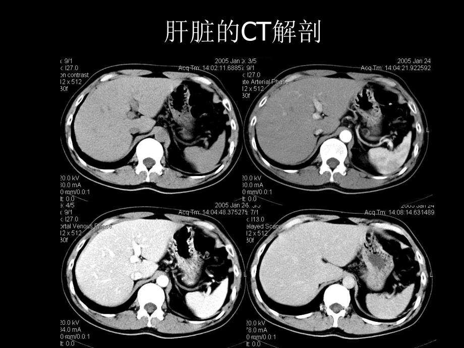 腹部CT正常解剖PPT课件_第4页