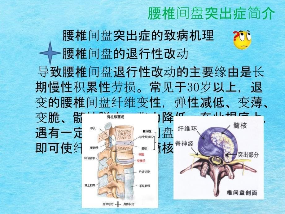 浅谈腰间盘突出病理及治疗ppt课件_第5页