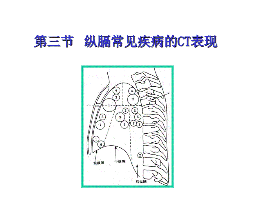 纵膈常见疾病的CT表现_第1页