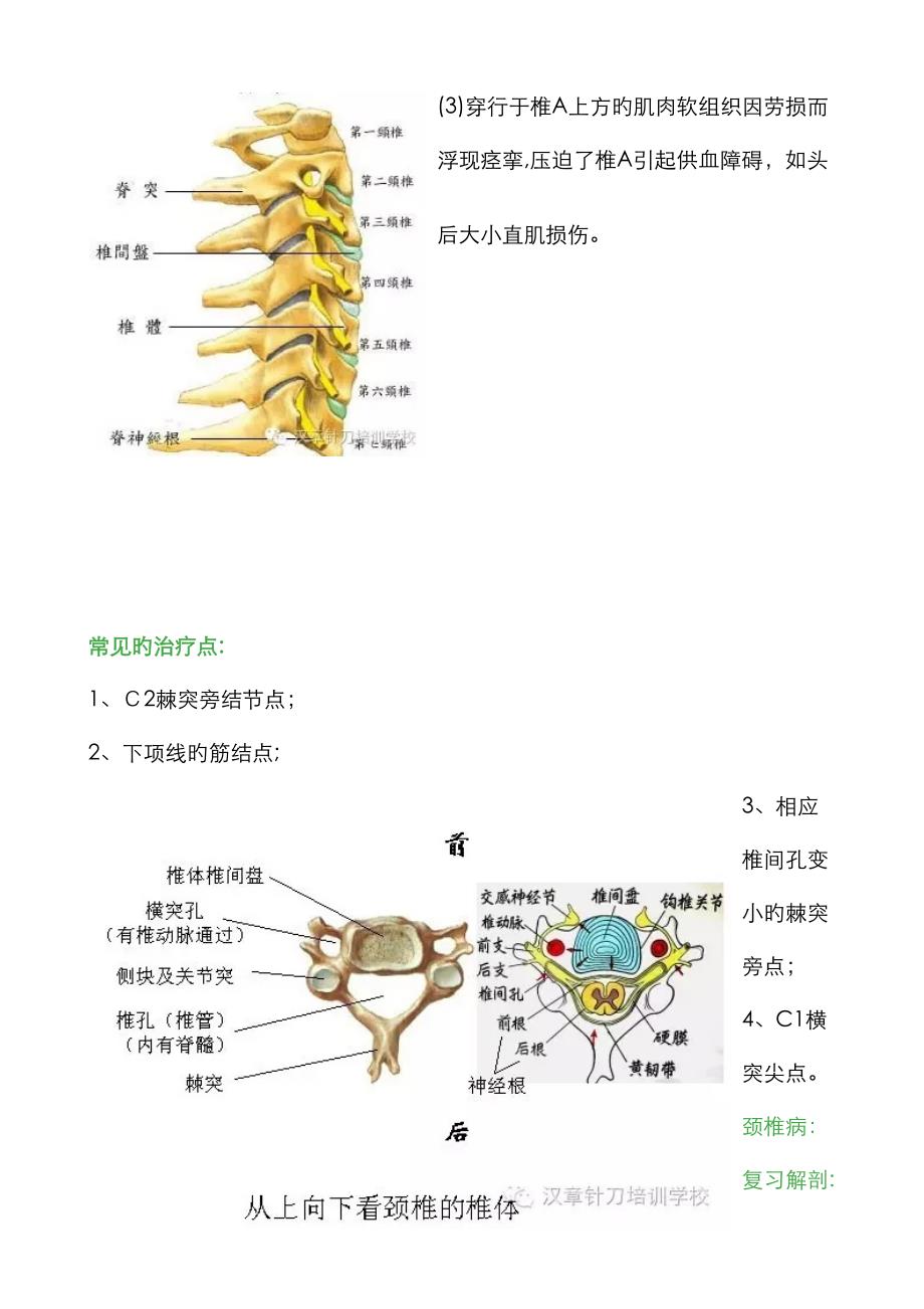 针刀常见的松解部位定位方法_第4页