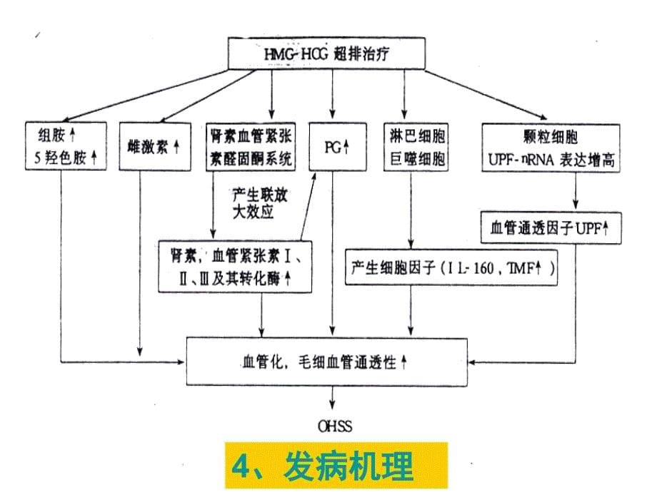 卵巢过度刺激综合征_第5页