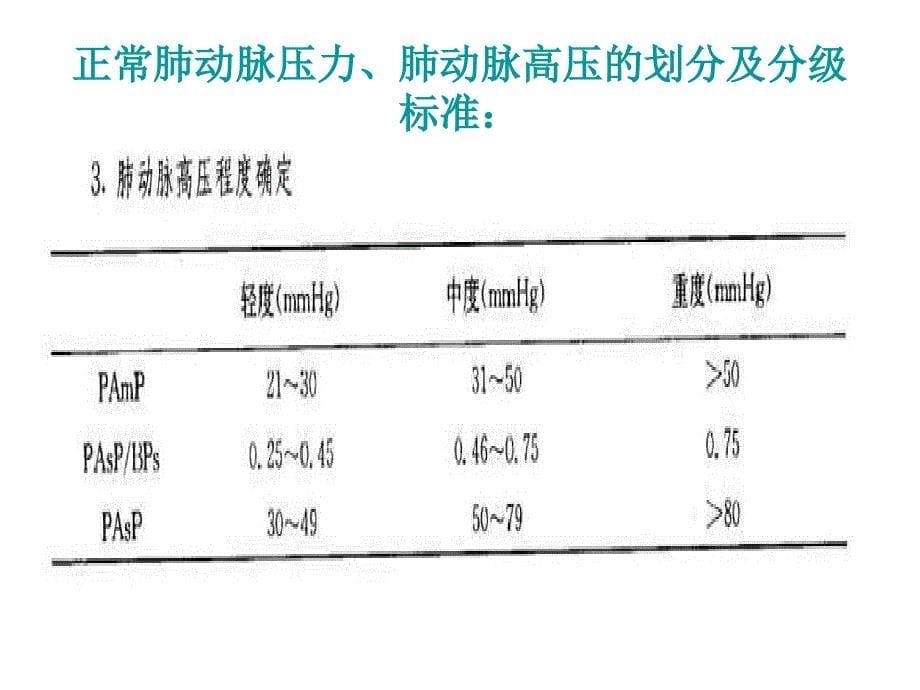 肺动脉压力测定PPT课件_第5页