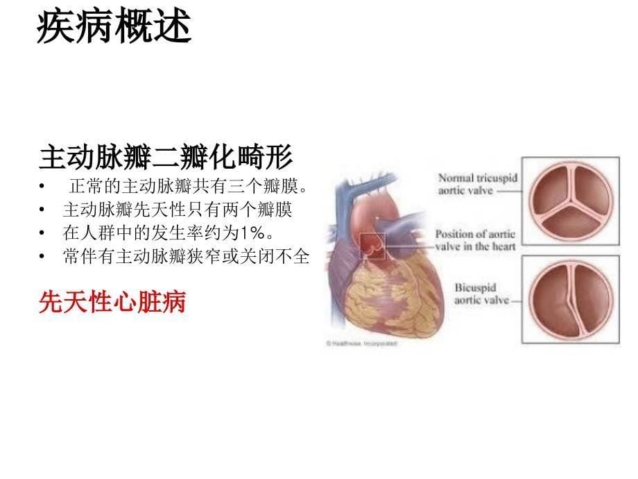 心脏外科护理查房课件_第5页