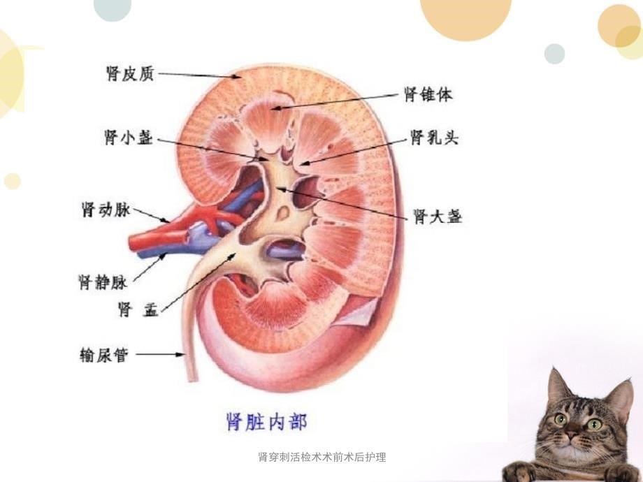 肾穿刺活检术术前术后护理课件_第5页