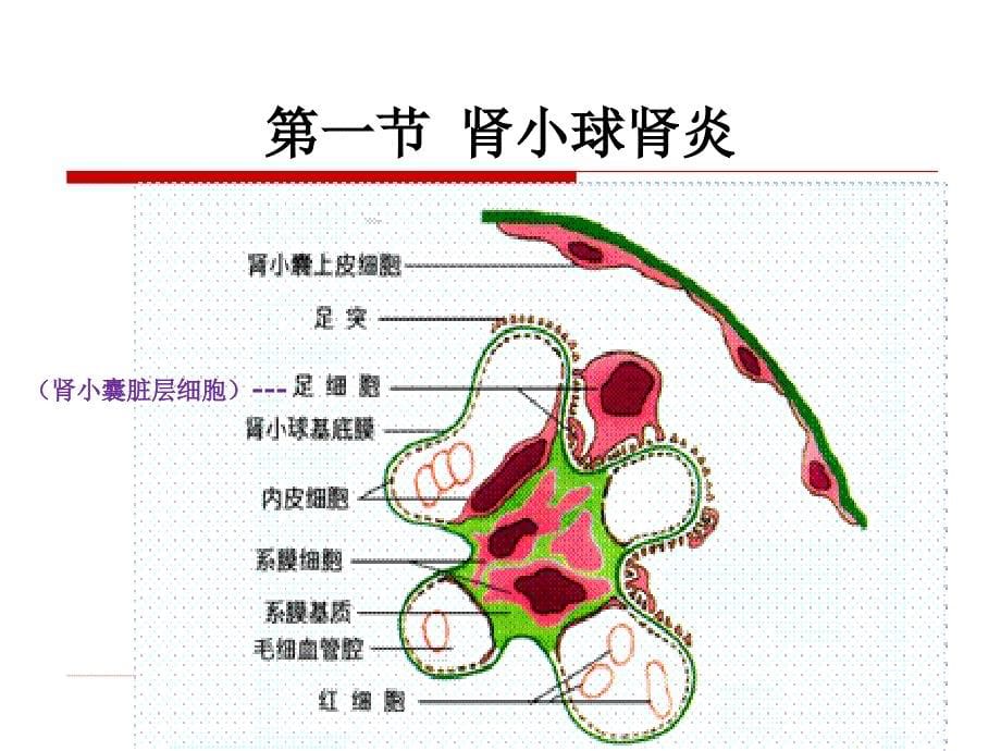 泌尿系统常见疾病病理生理学教学提纲_第5页