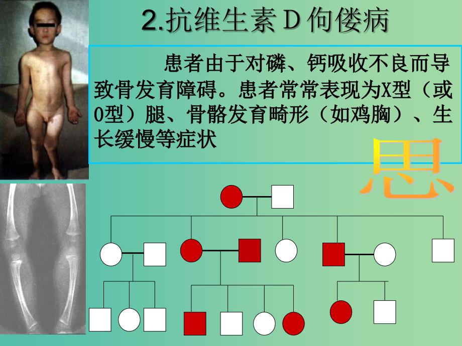 江西省吉安县高中生物第二章基因和染色体的关系2.3伴性遗传课时2课件新人教版必修2 .ppt_第3页