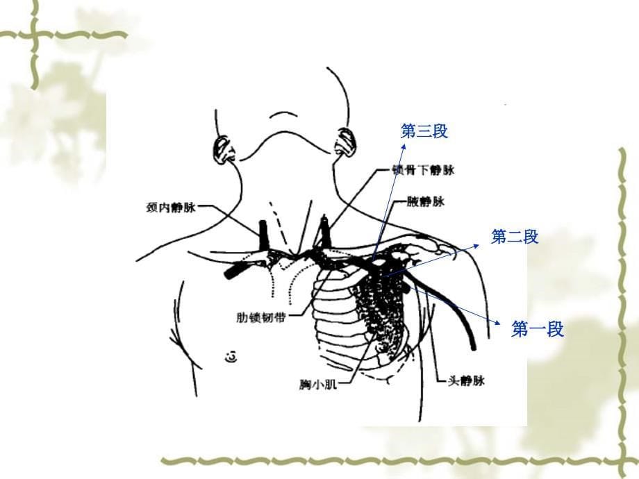 浅谈腋静脉穿刺术课件_第5页