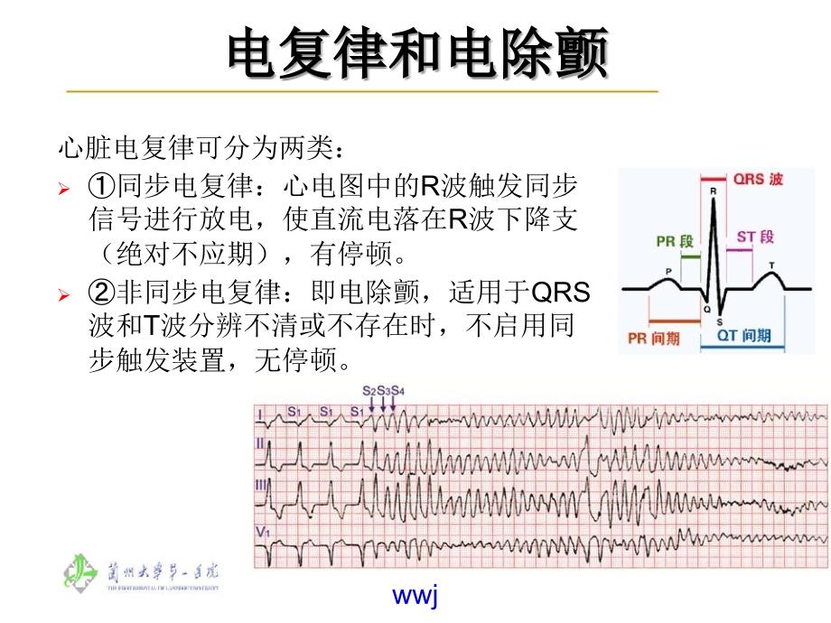 心脏骤停心电图类型心室静止课件_第4页