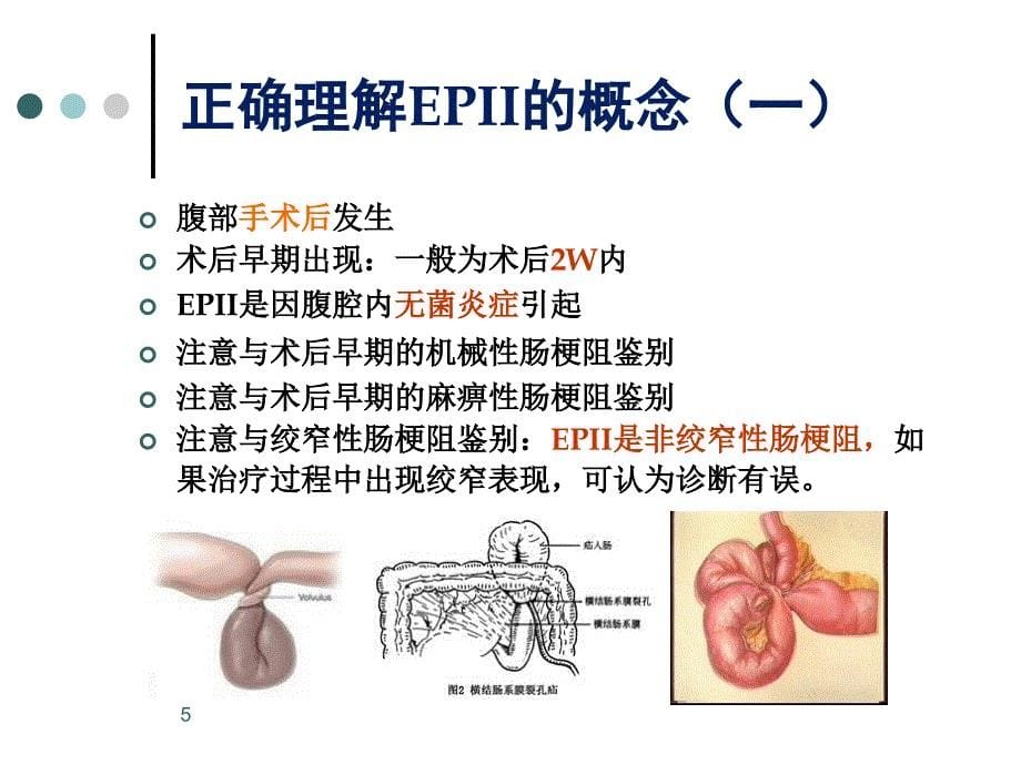 术后早期炎性肠梗阻ppt课件_第5页