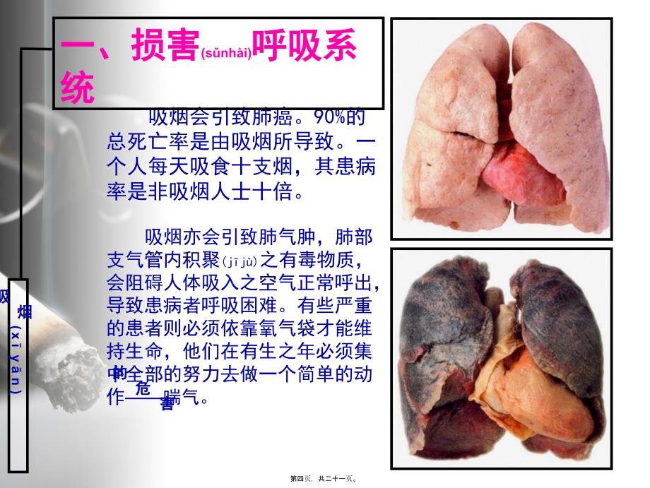 医学专题—吸烟喝酒有害健康_第4页