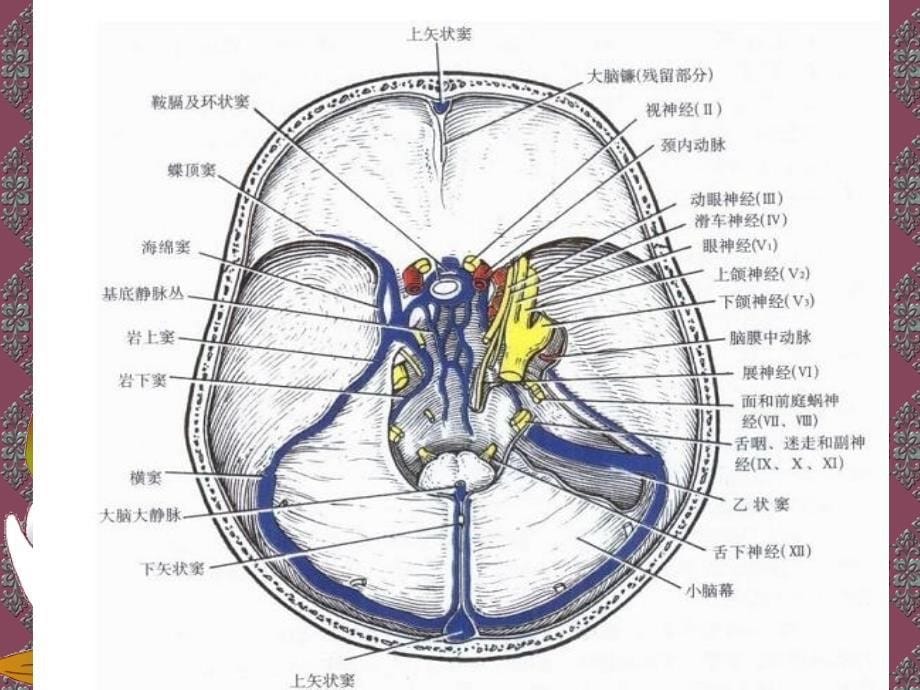 最新颈动脉海绵窦瘘PPT文档_第5页