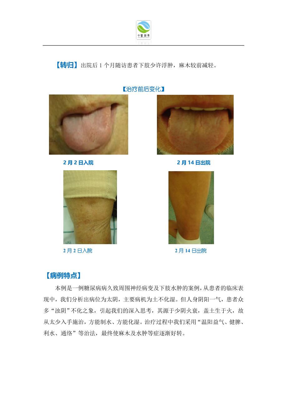 【经典之声】中医经典科初期典型案例之64(糖尿病下肢水肿麻木案).doc_第4页