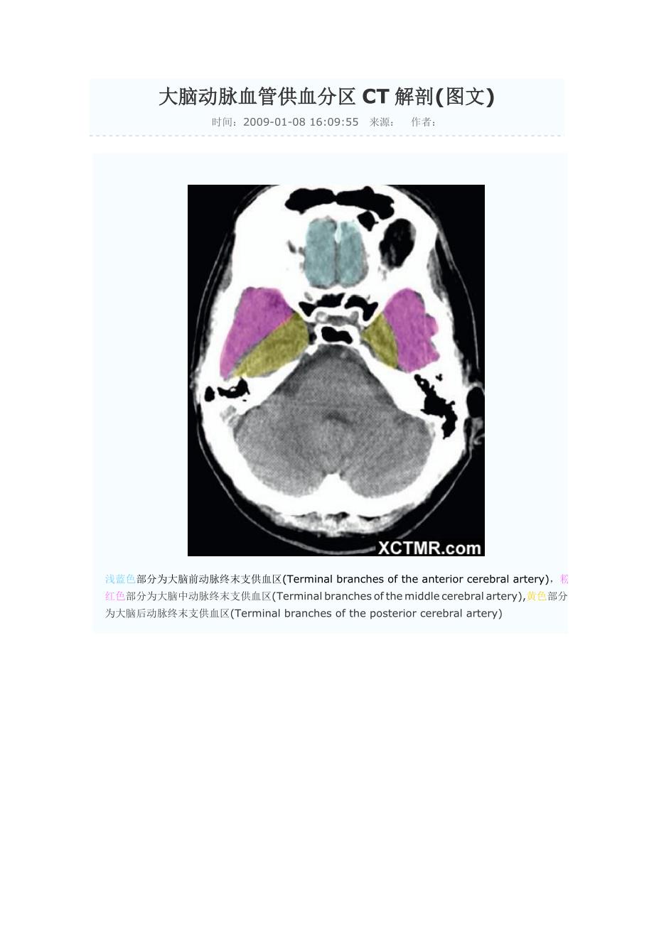 大脑动脉血管供血分区CT解剖图文_第1页