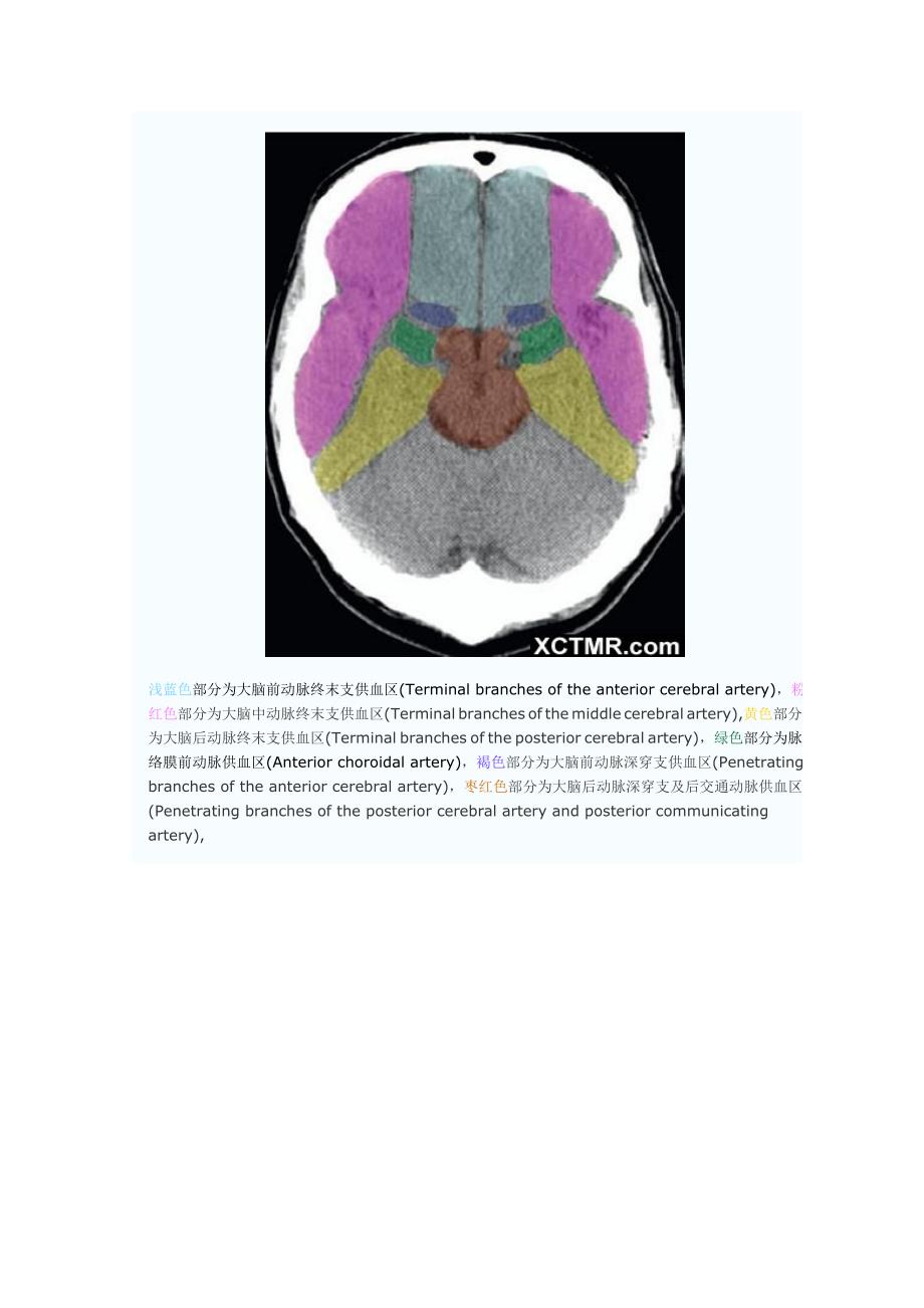 大脑动脉血管供血分区CT解剖图文_第3页