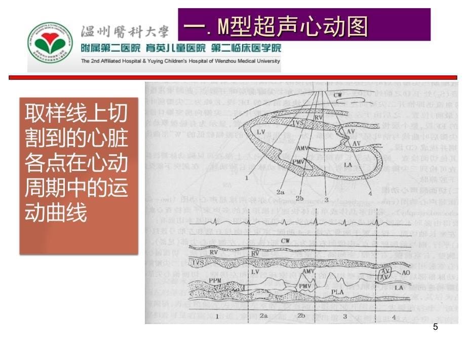 《医学影像学》课件：第二章：心超_第5页