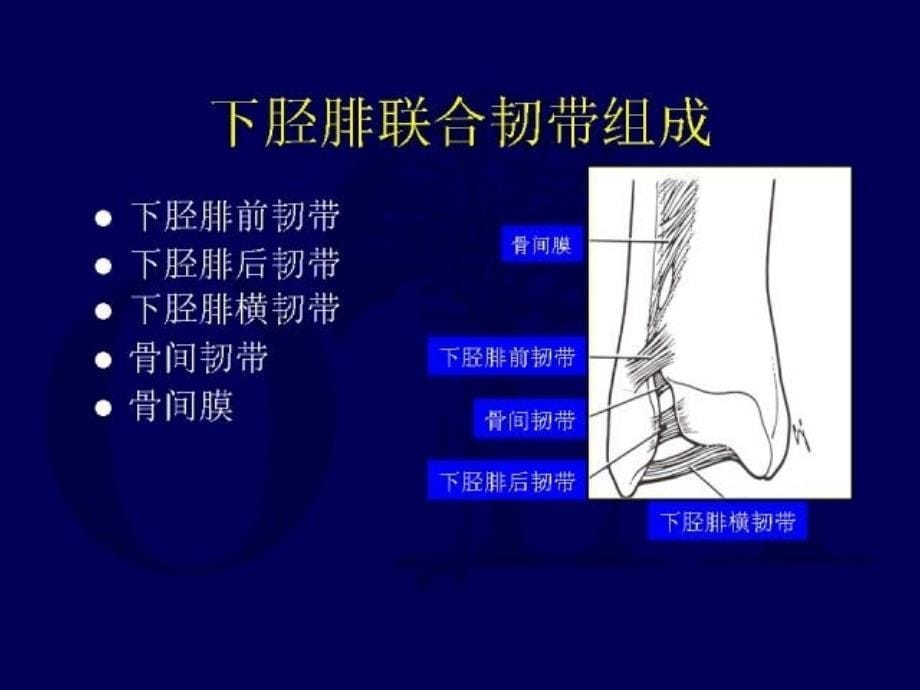 下胫腓联合分离的机制与处理.ppt_第5页