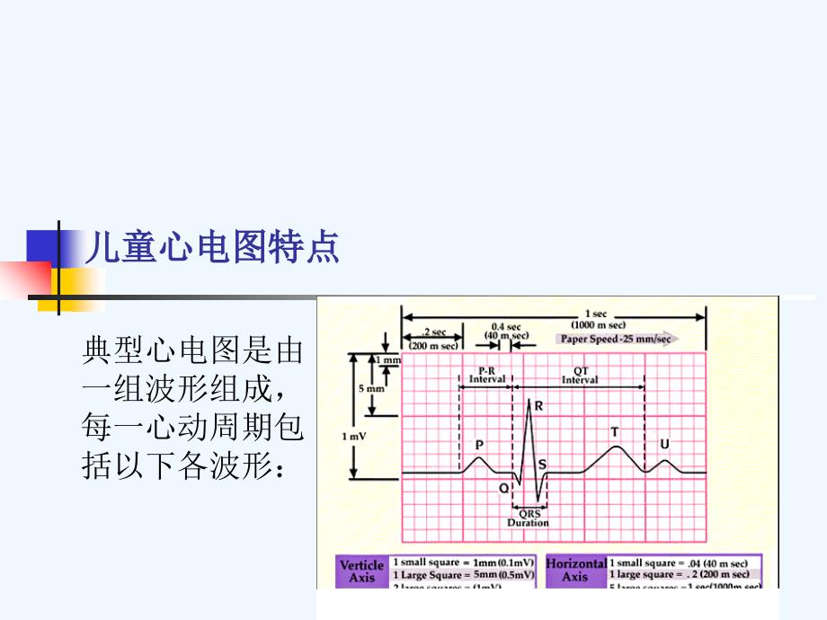 儿童心电图特点_第2页