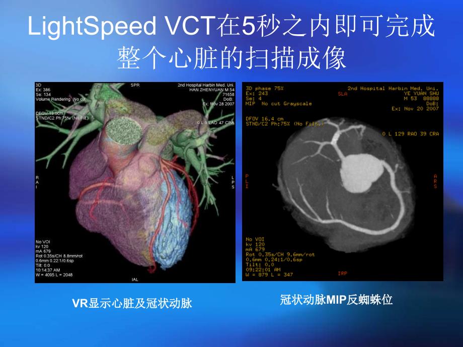 64排螺旋ct新技术的临床应用_第5页