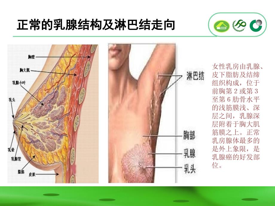 推荐精选乳腺癌术后功能锻炼_第3页