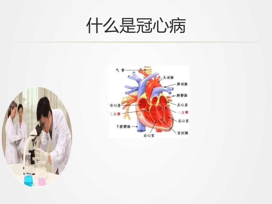 《冠心病健康手册》ppt.ppt_第2页