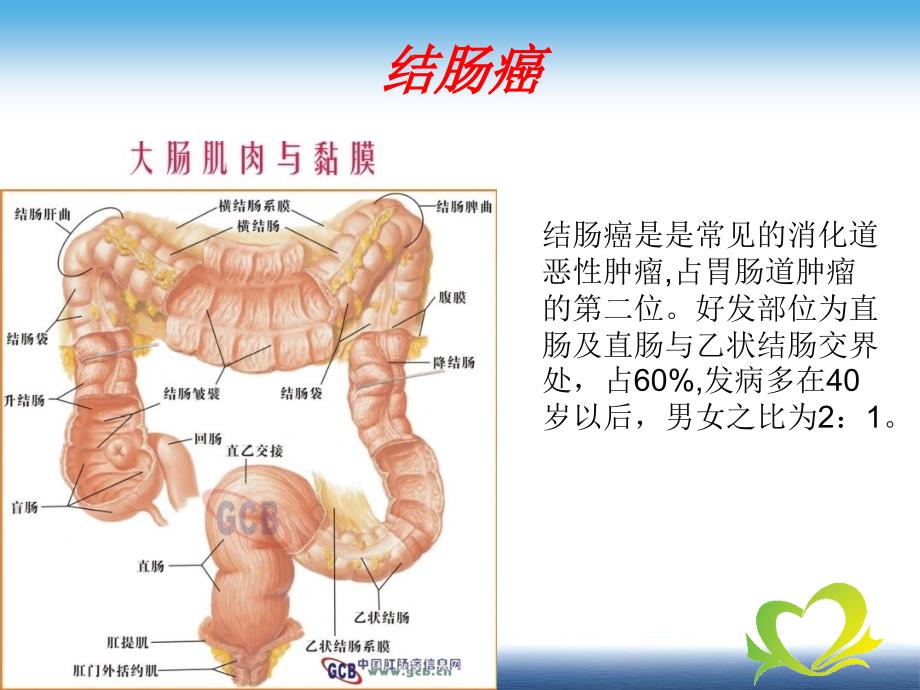 结肠癌术后化疗教学查房.ppt_第3页