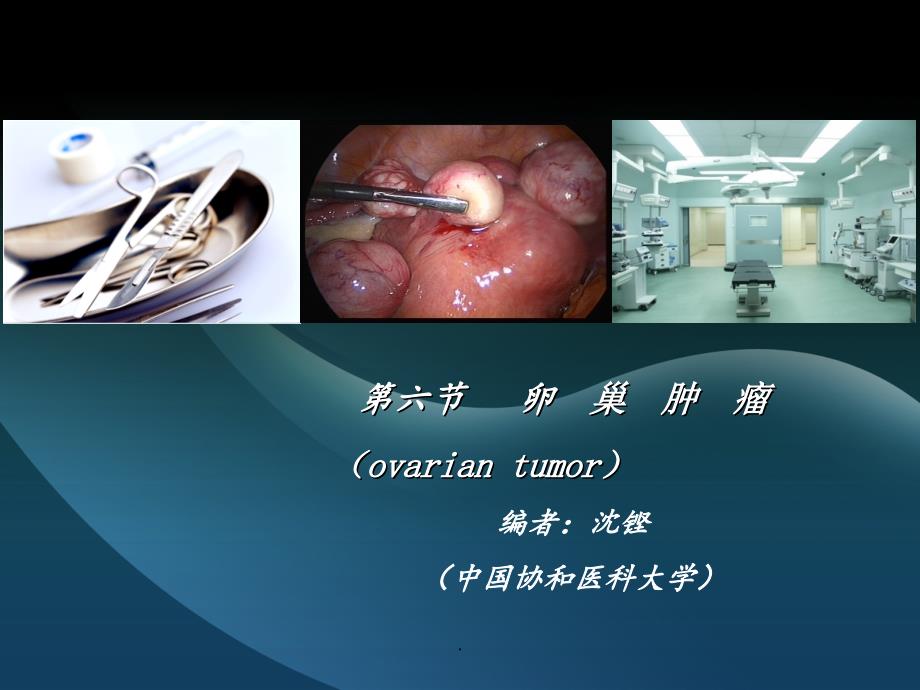 卵巢肿瘤课件_第1页