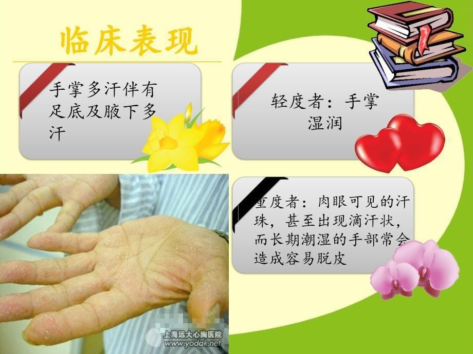 手汗症的护理.ppt_第5页