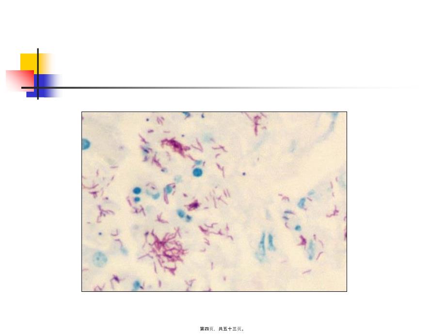 医学专题—呼吸道感染的细菌12077_第4页